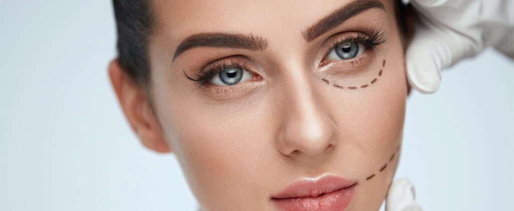 Blepharoplasty