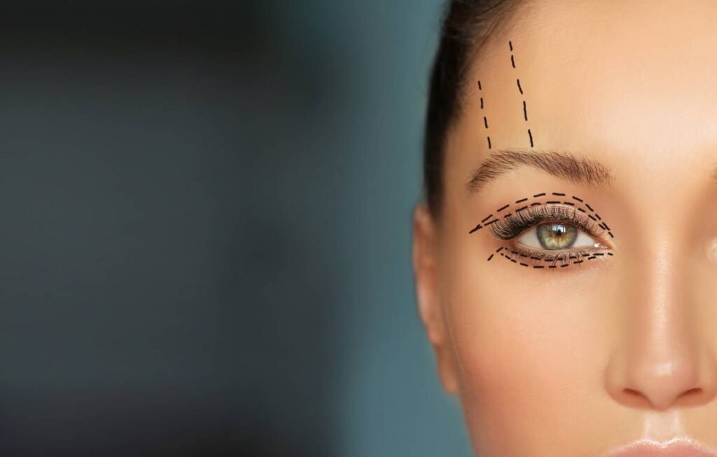 blepharoplasty dubai