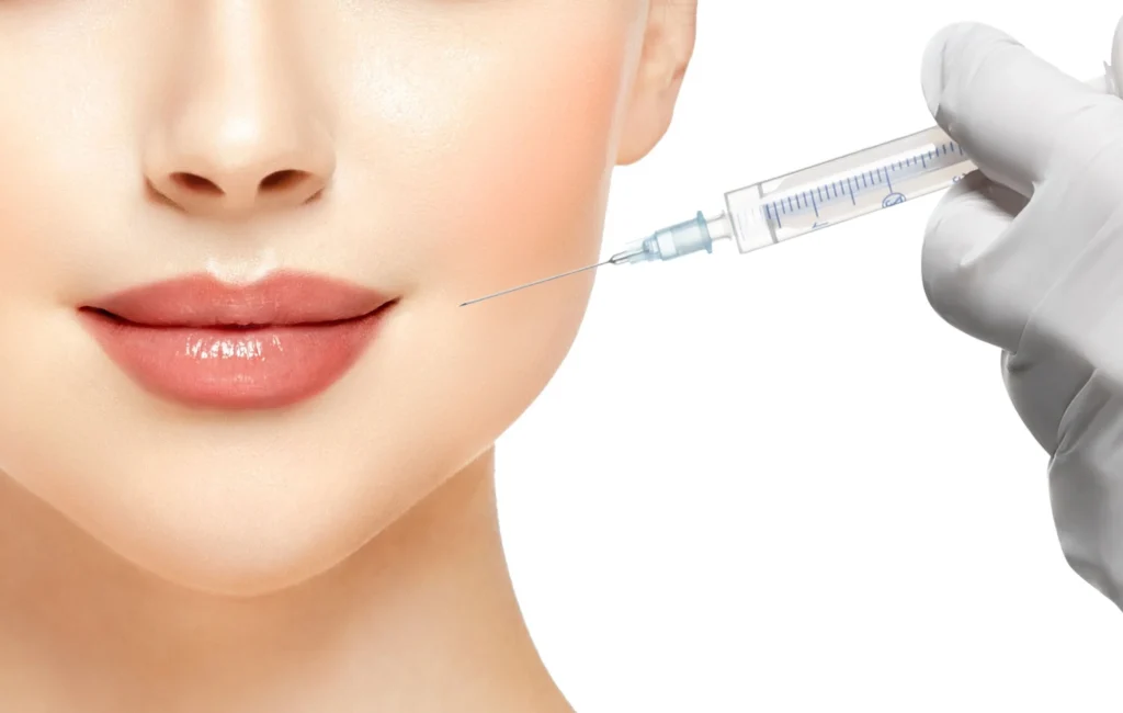 dermal fillers
