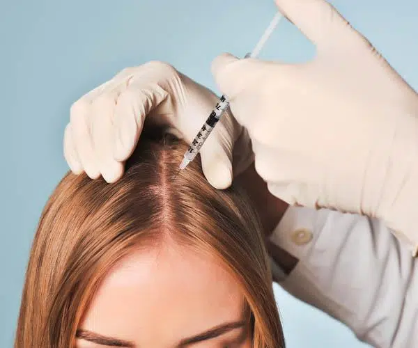 What Should You Expect During a Scalp Mesotherapy Treatment in Dubai?