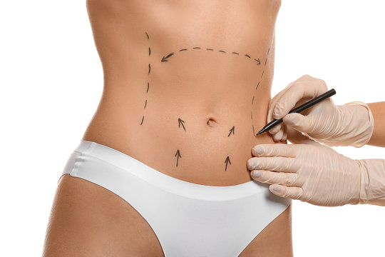 Can Tummy Tuck Surgery be combined with a breast procedure? 1 Tummy Tuck Surgery
