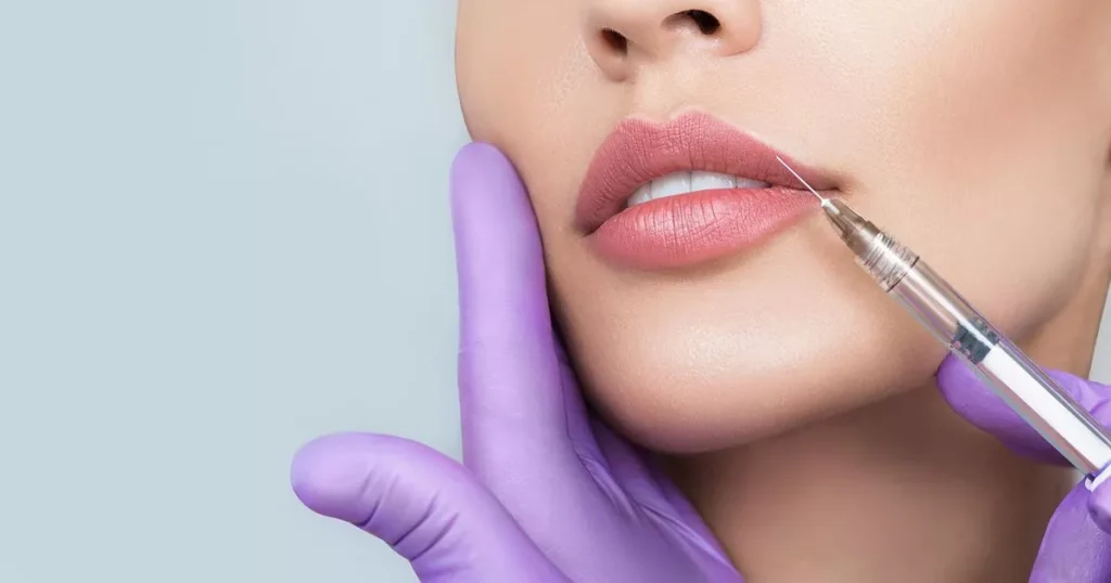 How long does lip filler dubai last compared to implants? 1 lip filler dubai